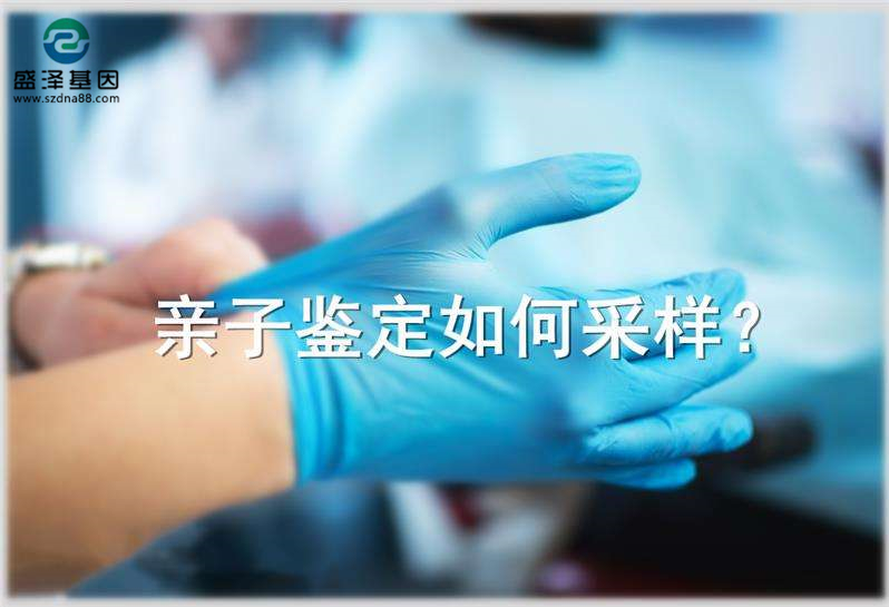 偷偷撿了一把頭發(fā)可以送去做親子鑒定嗎？
