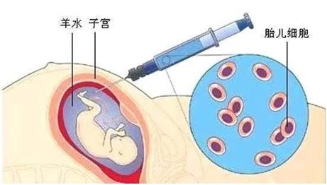 無創(chuàng)胎兒親子鑒定、羊水親子鑒定、毛發(fā)親子鑒定分別怎么做？