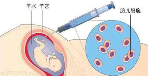 孕期做胎兒親子鑒定合適嗎？孕期有哪些胎兒親子鑒定方法？