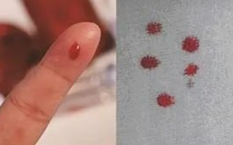 匿名親子鑒定需要準(zhǔn)備什么？親子鑒定工作人員采樣本流程有哪些？